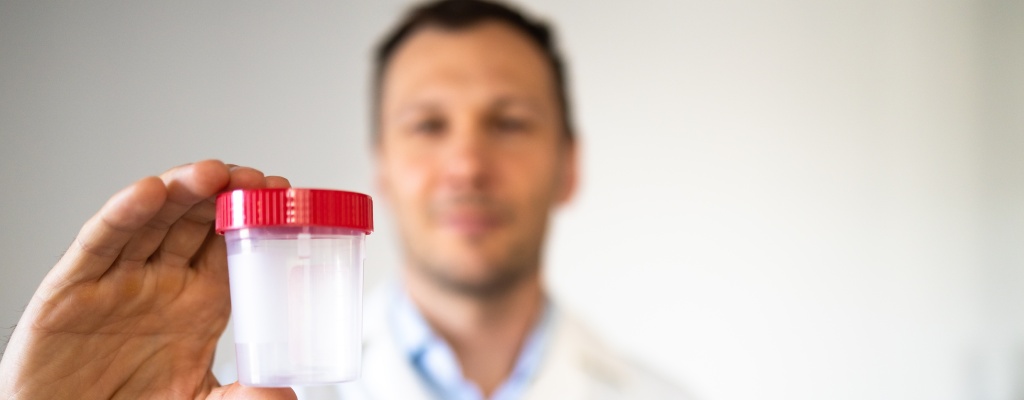 A technician holds an empty sample cup used for urine drug testing.