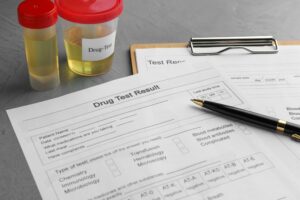 A form reading “Drug Test Result” sits on a table next to urine samples. 