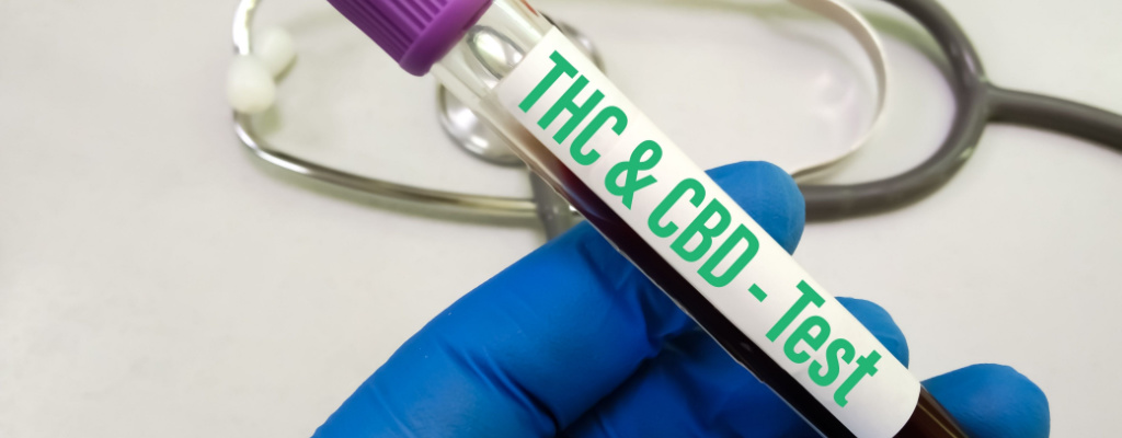 A gloved hand holds a vial labeled “THC & CBD - Test.”
